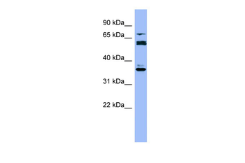 CYP2B6 Rabbit Polyclonal Antibody