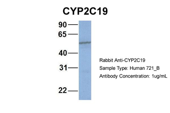CYP2C19 Rabbit Polyclonal Antibody