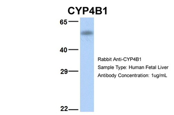 CYP4B1 Rabbit Polyclonal Antibody