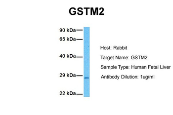 GSTM2 Rabbit Polyclonal Antibody