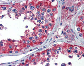 NPY1R Rabbit Polyclonal Antibody