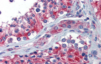 NPY1R Rabbit Polyclonal Antibody