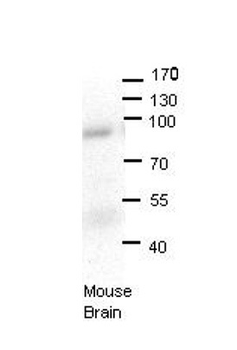 LSS Rabbit Polyclonal Antibody