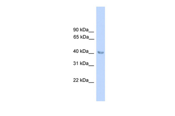 ALAD Rabbit Polyclonal Antibody