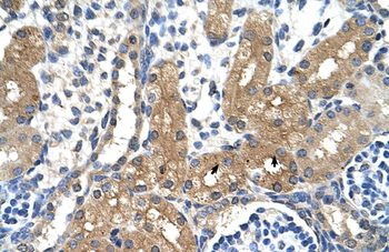 CYP4A22 Rabbit Polyclonal Antibody