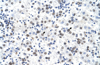 FECH Rabbit Polyclonal Antibody