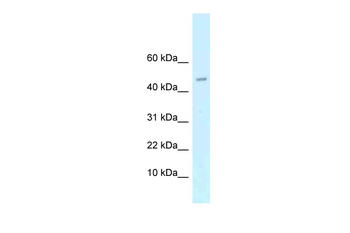 Arpp21 Rabbit Polyclonal Antibody