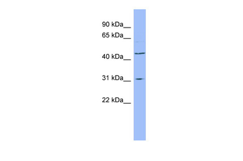 DHODH Rabbit Polyclonal Antibody