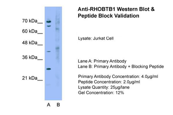 RHOBTB1 Rabbit Polyclonal Antibody
