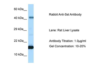 Sst Rabbit Polyclonal Antibody