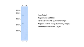 UGT2B15 Rabbit Polyclonal Antibody