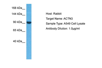 ACTN3 Rabbit Polyclonal Antibody