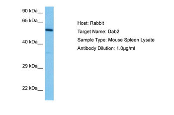 DAB2 Rabbit Polyclonal Antibody
