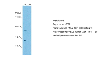 IGSF1 Rabbit Polyclonal Antibody