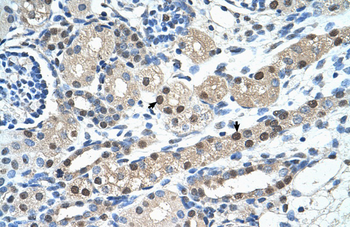 IGSF1 Rabbit Polyclonal Antibody