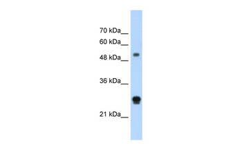 IGSF1 Rabbit Polyclonal Antibody