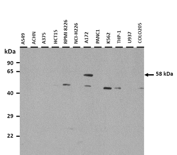 ALPP Rabbit Polyclonal Antibody
