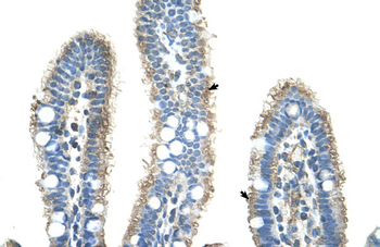 APCS Rabbit Polyclonal Antibody