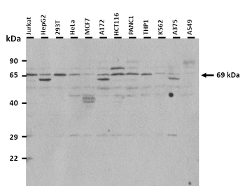 DLAT Rabbit Polyclonal Antibody