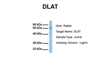 DLAT Rabbit Polyclonal Antibody