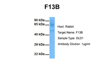 F13B Rabbit Polyclonal Antibody