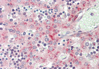 F13B Rabbit Polyclonal Antibody