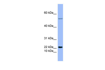 GCG Rabbit Polyclonal Antibody