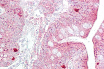 KRT8 Rabbit Polyclonal Antibody
