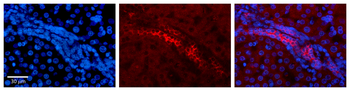 KRT8 Rabbit Polyclonal Antibody