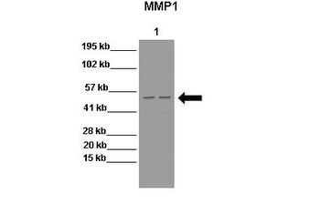 MMP1 Rabbit Polyclonal Antibody