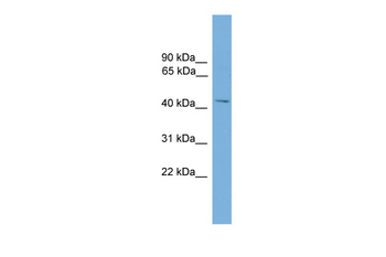 MMP3 Rabbit Polyclonal Antibody