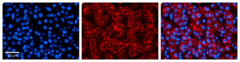 MAP2K3 Rabbit Polyclonal Antibody
