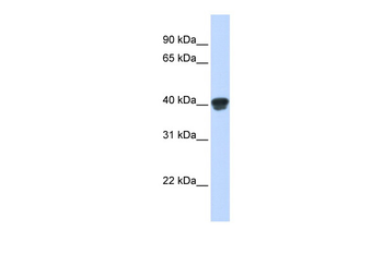 MAP2K3 Rabbit Polyclonal Antibody