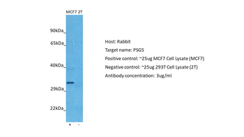 PSG5 Rabbit Polyclonal Antibody