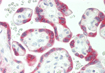 PSG5 Rabbit Polyclonal Antibody