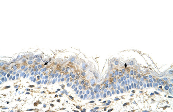 S100A3 Rabbit Polyclonal Antibody