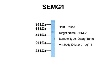 SEMG1 Rabbit Polyclonal Antibody