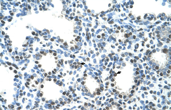 SEMG1 Rabbit Polyclonal Antibody