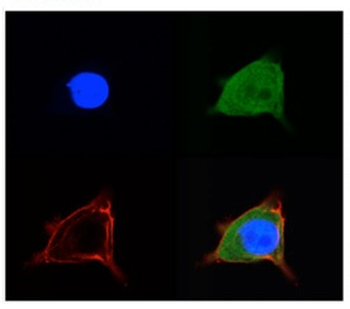 SLC2A5 Rabbit Polyclonal Antibody