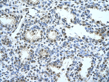 SQLE Rabbit Polyclonal Antibody