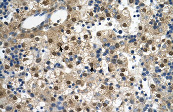 SQLE Rabbit Polyclonal Antibody