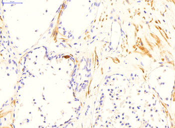 TGM4 Rabbit Polyclonal Antibody