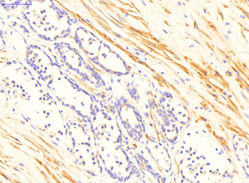 TGM4 Rabbit Polyclonal Antibody