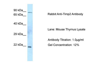 Timp2 Rabbit Polyclonal Antibody
