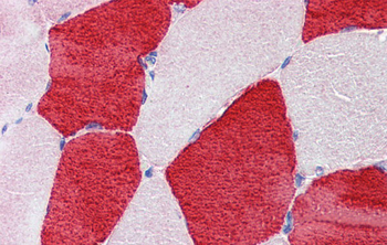 TNNI1 Rabbit Polyclonal Antibody