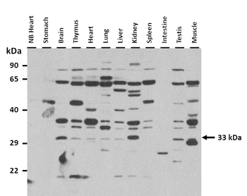 TNNT1 Rabbit Polyclonal Antibody