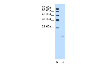 PPFIBP1 Rabbit Polyclonal Antibody
