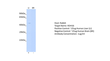 RDH16 Rabbit Polyclonal Antibody