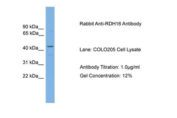 RDH16 Rabbit Polyclonal Antibody
