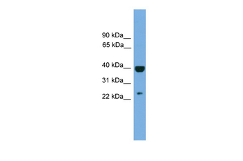 SOCS1 Rabbit Polyclonal Antibody